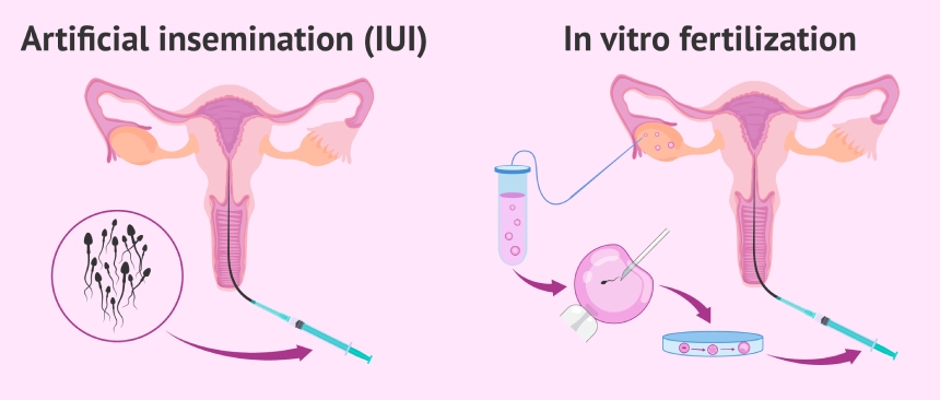 Kết Luận và Đề Xuất