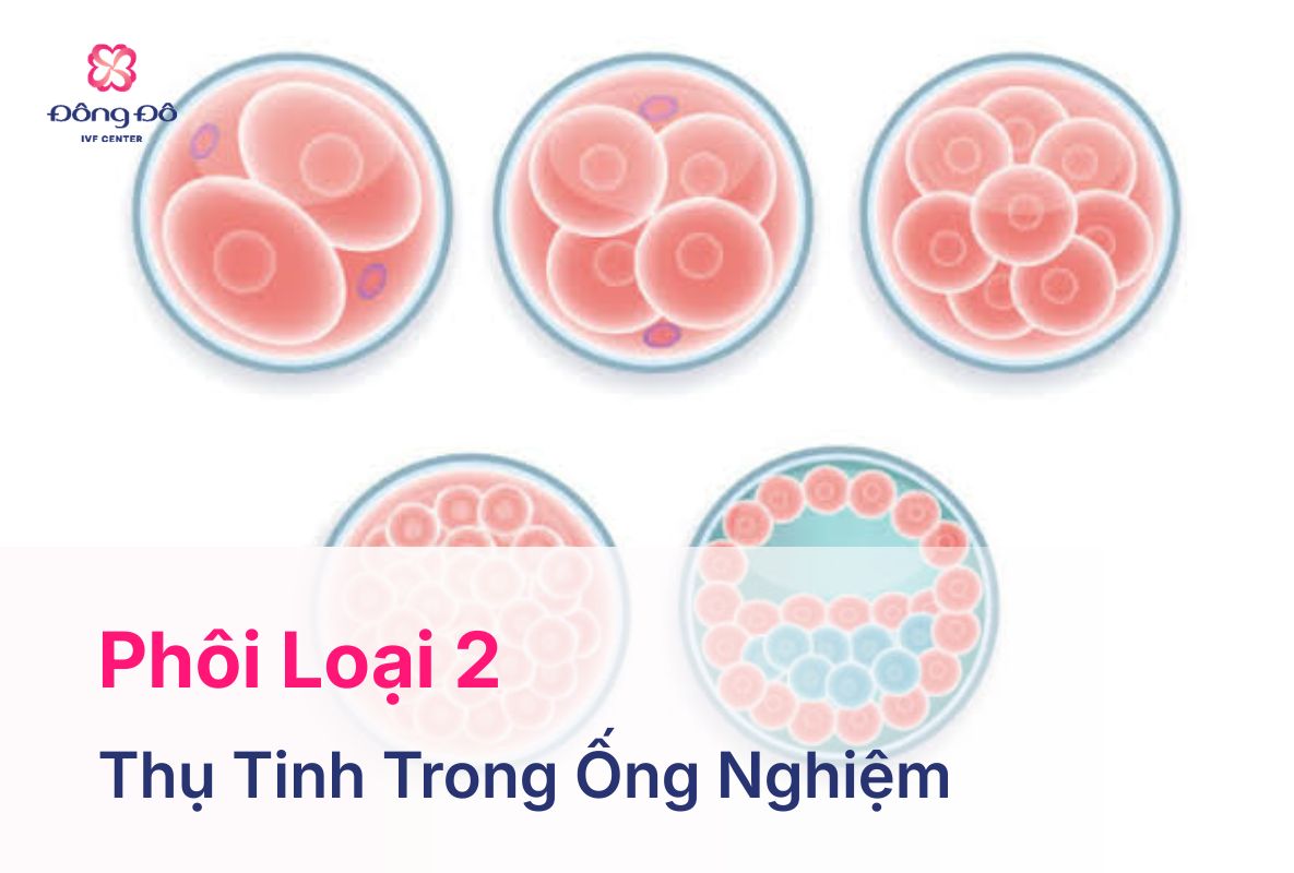 Phôi Loại 2 Là Gì? Có Nên Chuyển Phôi Loại 2 Không?