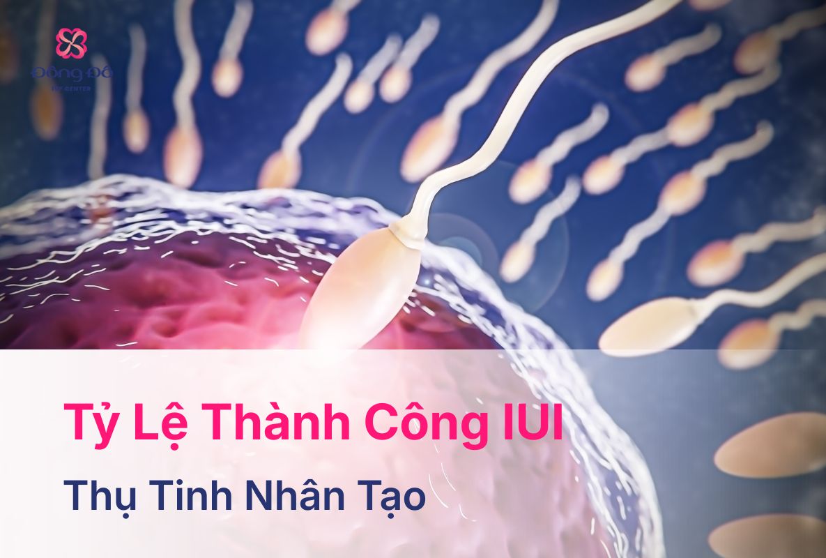 Tỷ Lệ Thành Công IUI Là Bao Nhiêu? 5 Yếu Tố Ảnh Hưởng