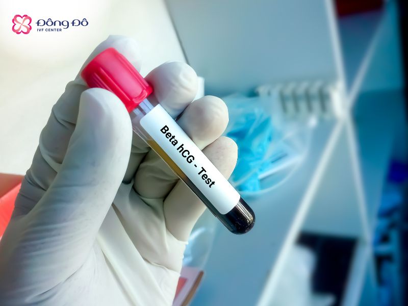 Xét nghiệm beta hCG là cách xác định khả năng có thai chính xác