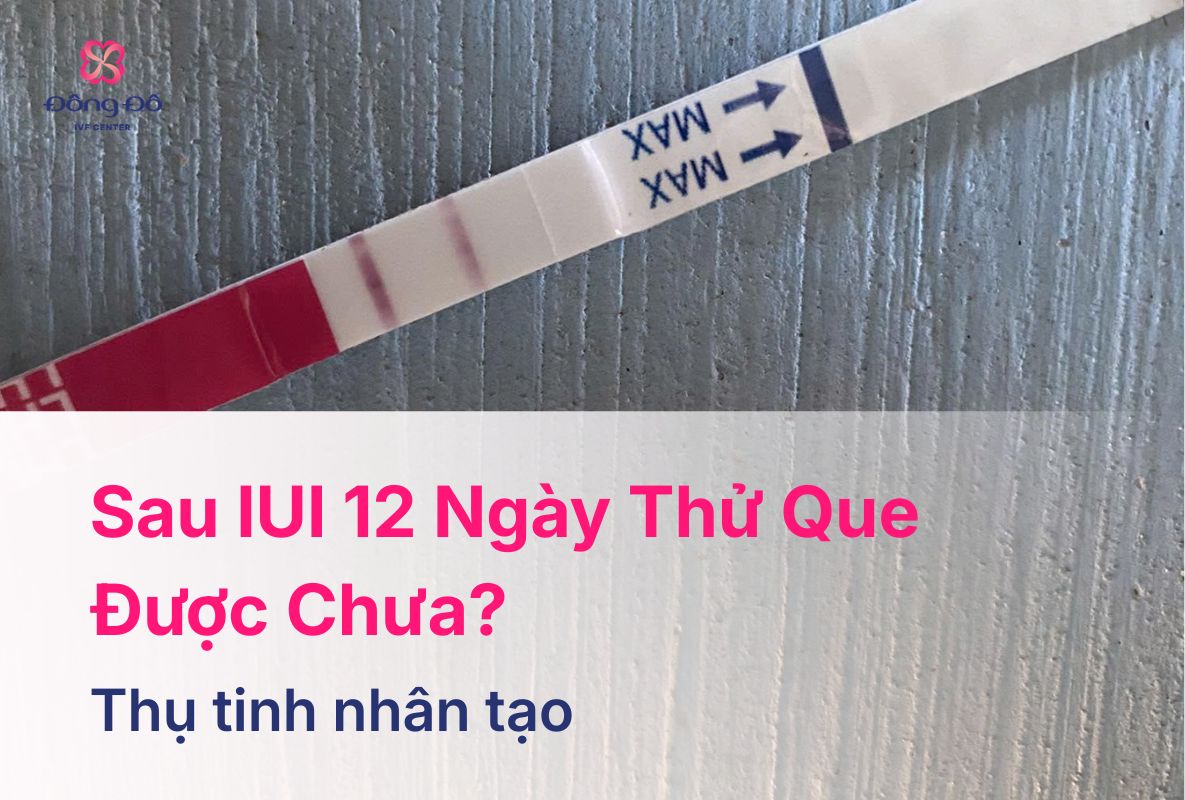 Sau IUI 12 Ngày Thử Que Được Chưa? Nên Làm Gì Tiếp Theo?