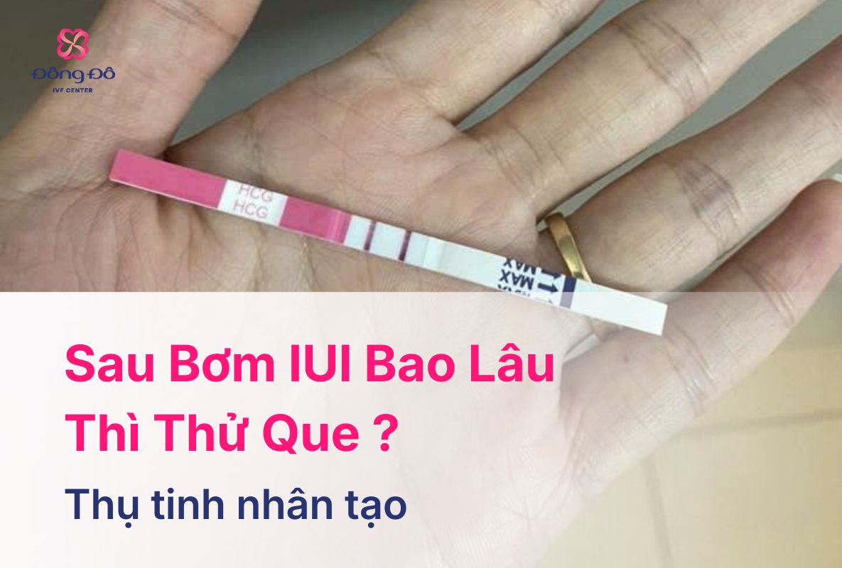 Sau Bơm IUI Bao Lâu Thì Thử Que Để Biết Kết Quả Chính Xác?