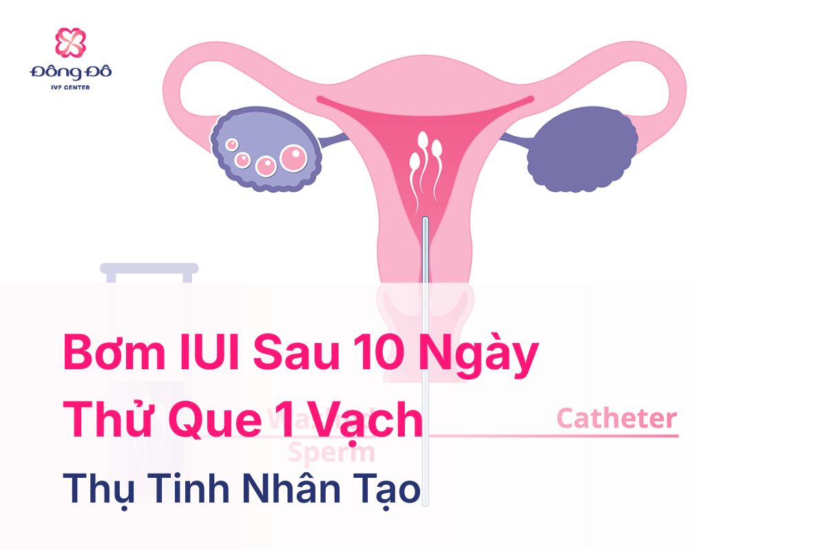 Bơm IUI Sau 10 Ngày Thử Que 1 Vạch Có Phải Thất Bại Không?