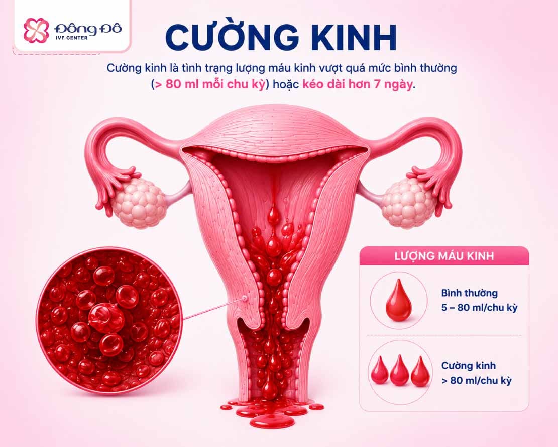 Polyp cổ tử cung