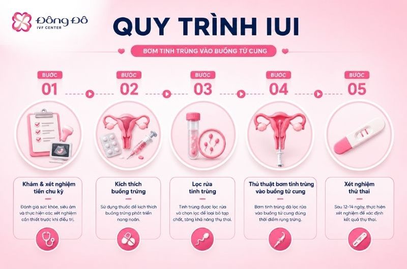 Inforgraphic quy trình làm IUI