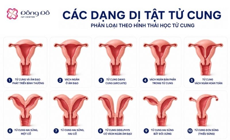 Một số bất thường ở tử cung
