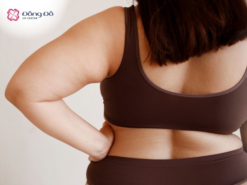 Béo phì làm tăng nồng độ Estrogen, tăng độ dày niêm mạc tử cung