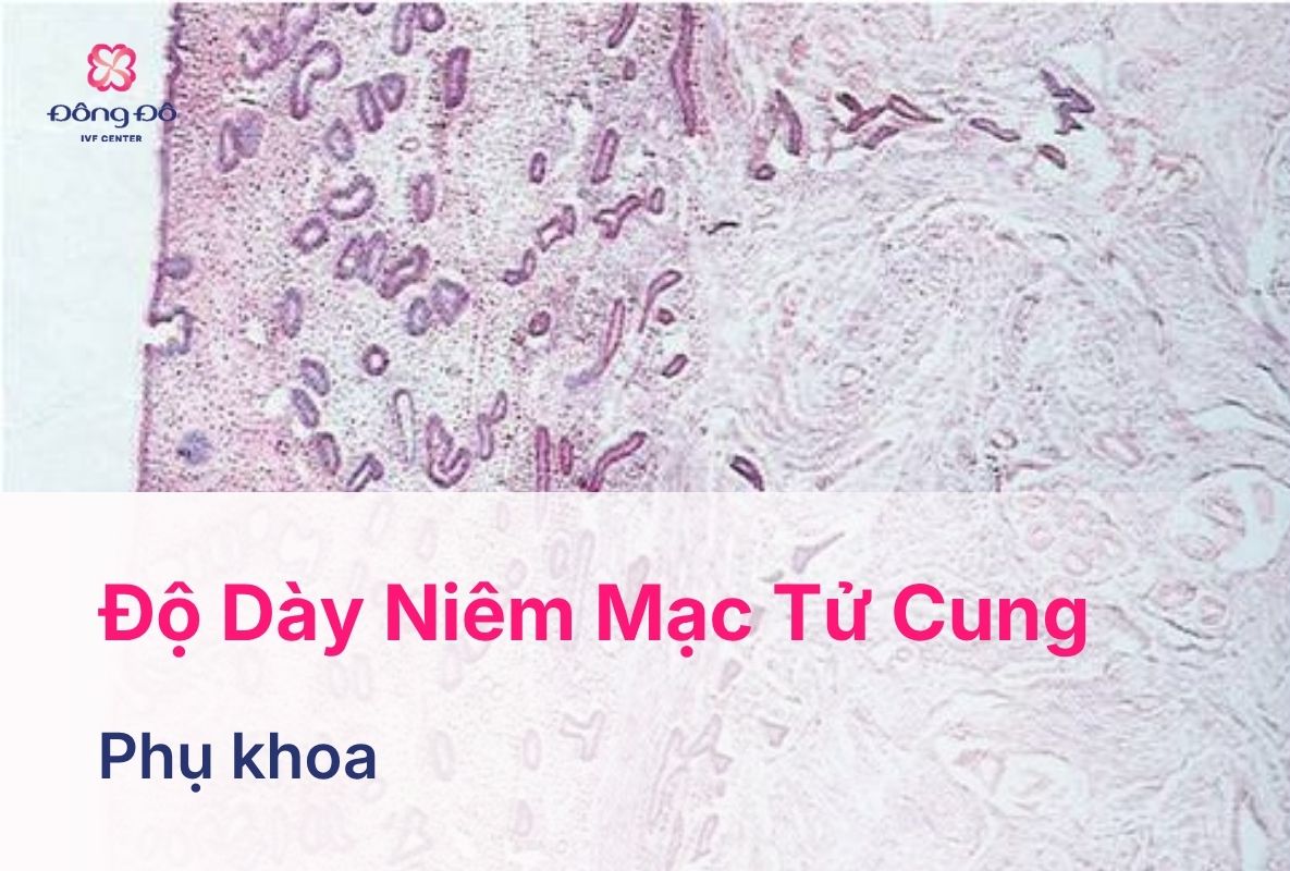 Độ Dày Niêm Mạc Tử Cung Phù Hợp Để Chuyển Phôi?