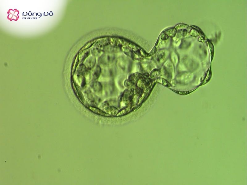 Hình ảnh phôi nang ngày 5 - phôi blastocyst - có tỷ lệ làm tổ thành công cao