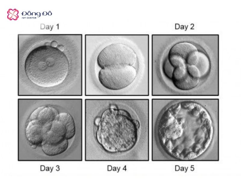 Hình ảnh sự phát triển của phôi từ ngày 1 đến ngày 5 (phôi ngày 5 - phôi nang - blastocyst)