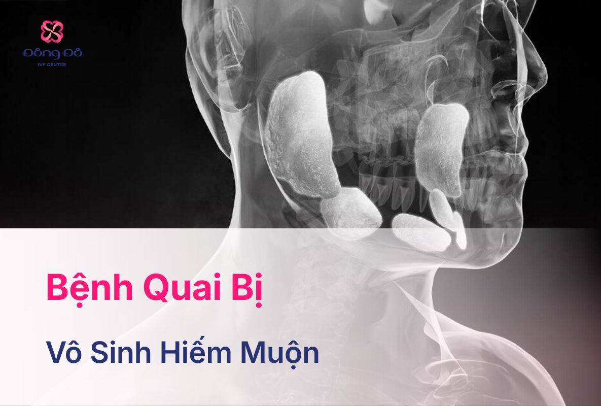 Bệnh Quai Bị: Nguyên Nhân, Triệu Chứng Và Cách Phòng Ngừa