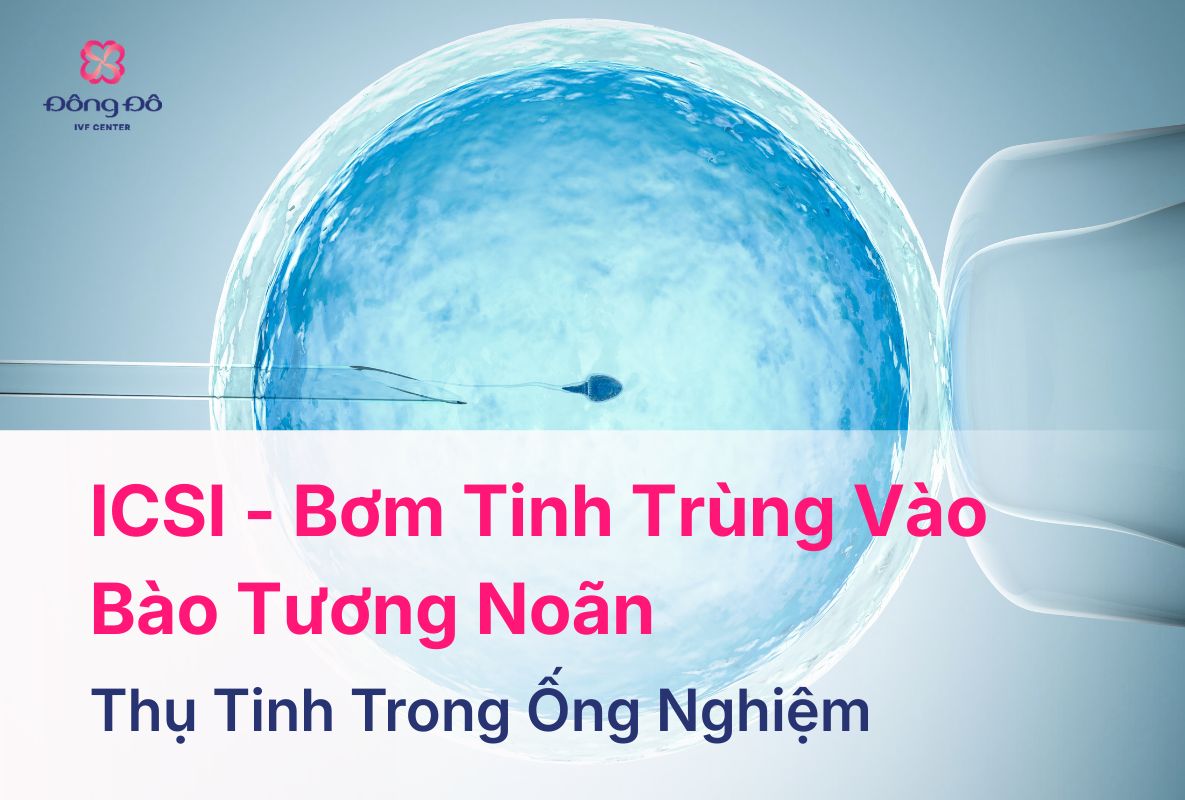 ICSI - Kỹ Thuật Tiêm Tinh Trùng Vào Bào Tương Noãn Là Gì?