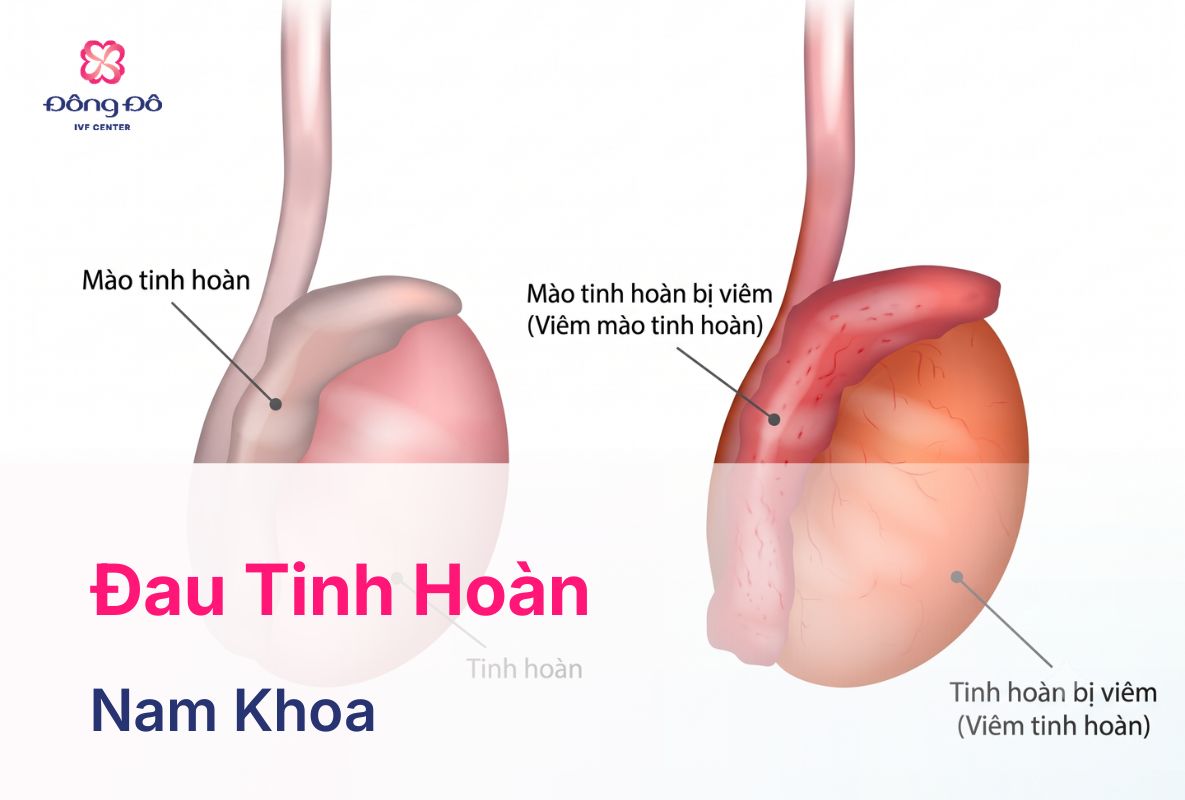Đau Tinh Hoàn: 20+ Nguyên Nhân Gây Bệnh, Cách Điều Trị