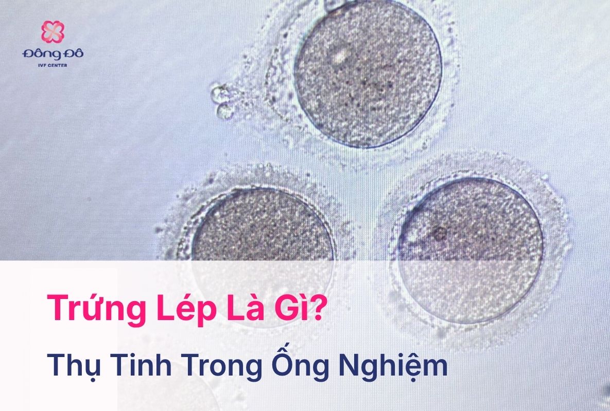 Trứng Lép Là Gì? Nguyên Nhân, Dấu Hiệu, Chẩn Đoán, Điều Trị