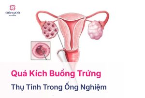 Quá Kích Buồng Trứng: Hiếm Gặp Nhưng Không Thể Chủ Quan