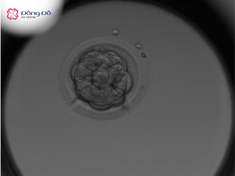 Hình ảnh phôi dâu (nguồn trực tiếp từ Labo Đông Đô IVF Center)