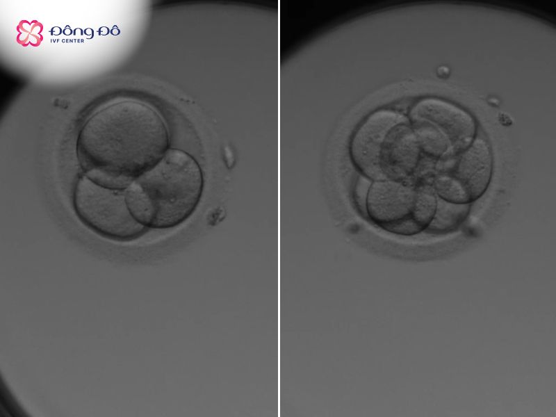 Hình ảnh phôi ngày 2 (bên trái) và phôi ngày 3 (bên phải) (nguồn trực tiếp từ Labo Đông Đô IVF Center)