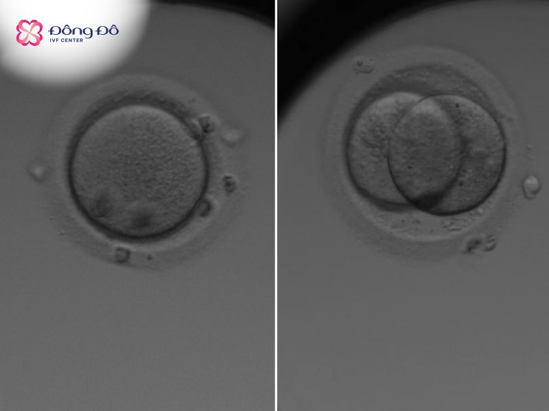 Hình ảnh phôi ngày 0 (bên trái) và phôi ngày 1 (bên phải) (nguồn trực tiếp từ Labo Đông Đô IVF Center)