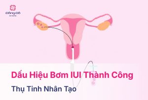 Chọc Hút Trứng Là Gì? Quy Trình, Lưu Ý Và Rủi Ro