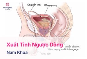 Xuất Tinh Ngược Dòng Là Gì? Nguyên Nhân, Chẩn Đoán Và Cách Điều Trị